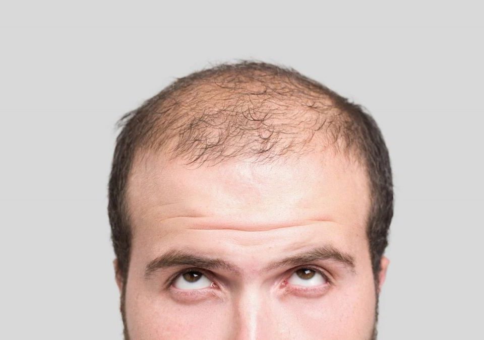 De cate ori poti face implant de par