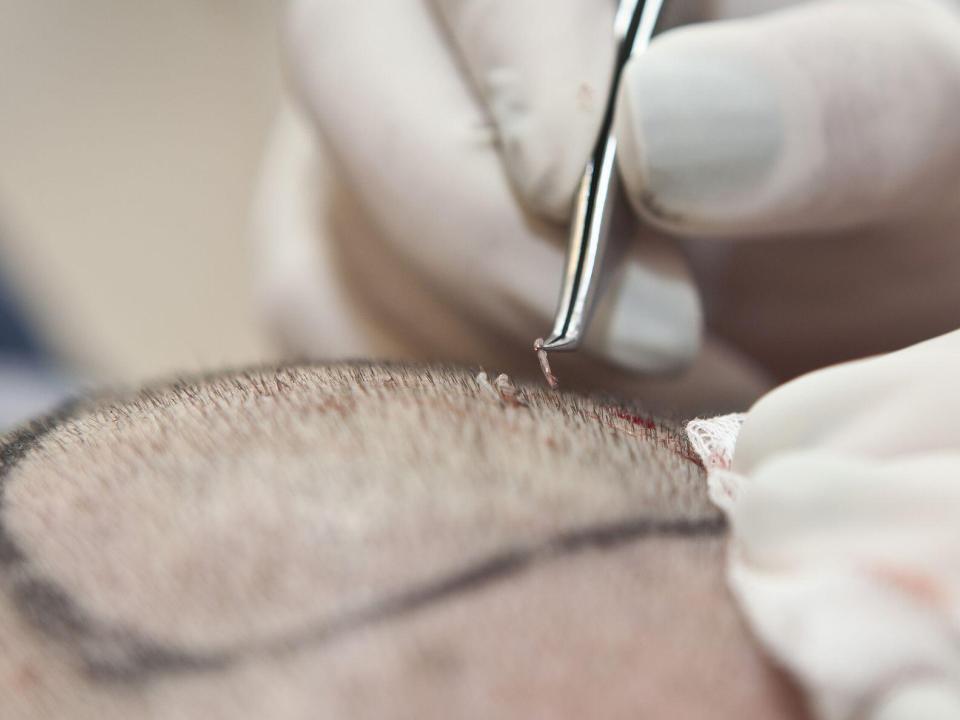 Implant de par riscuri