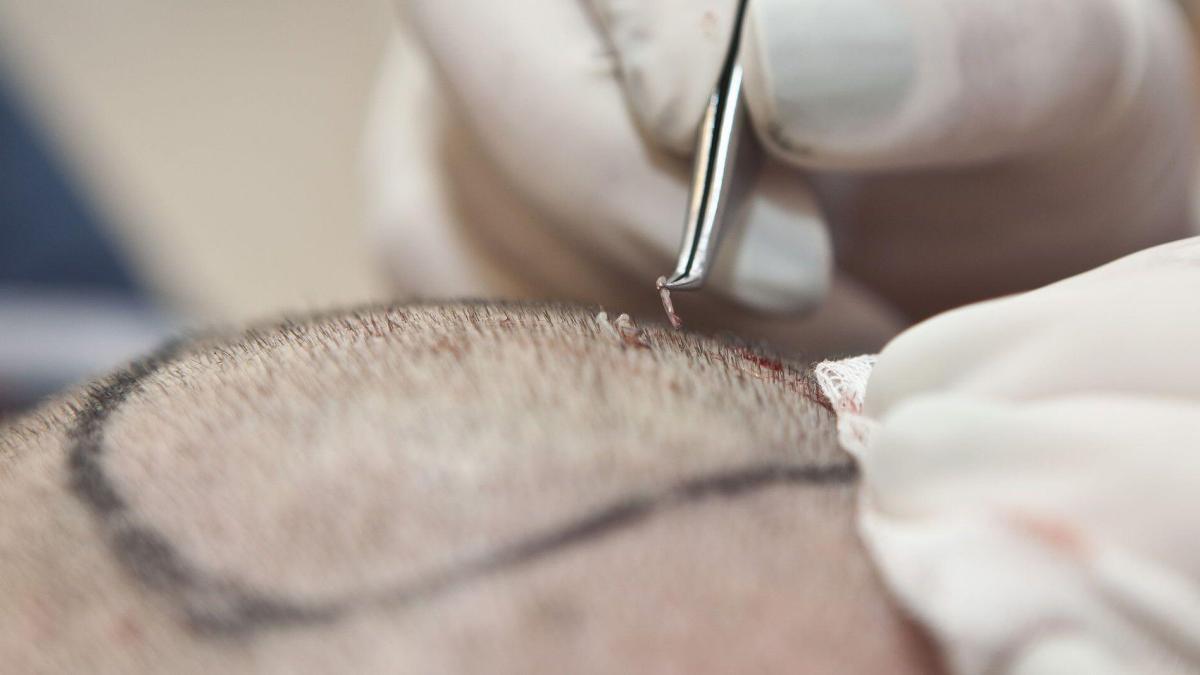 Clinica implant par