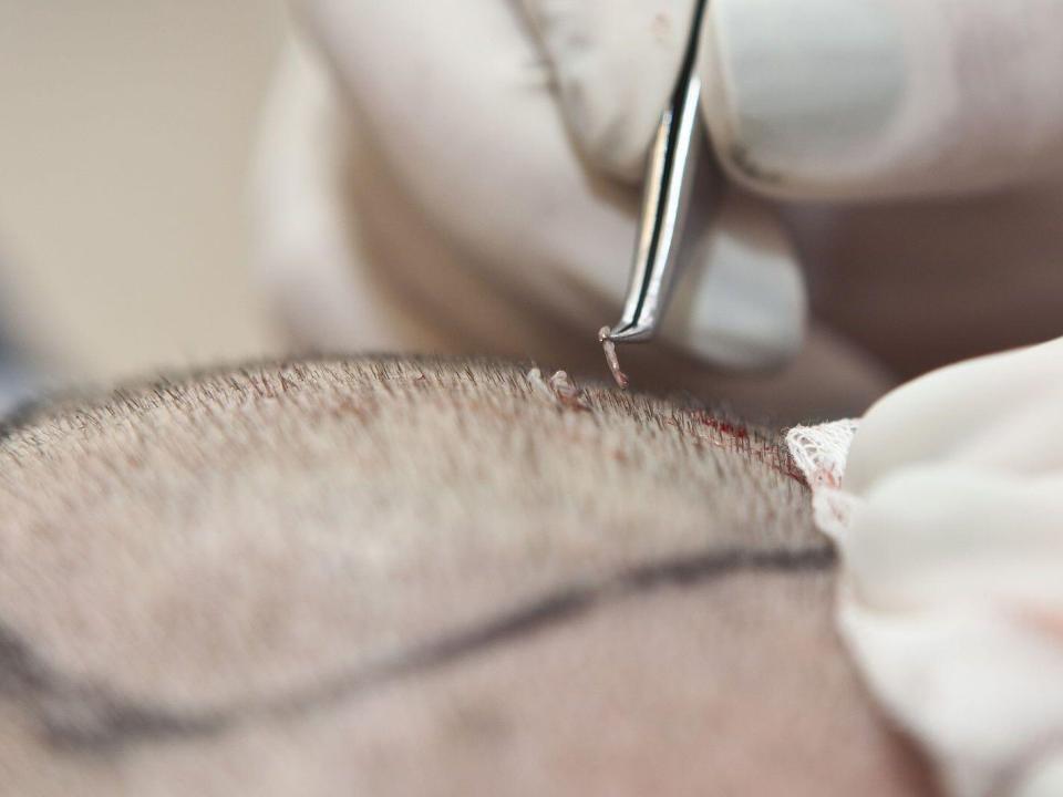 Clinica implant par